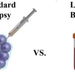 Focus sulla biopsia liquida: dalla diagnosi alla terapia