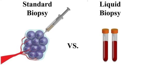 Focus sulla biopsia liquida: dalla diagnosi alla terapia